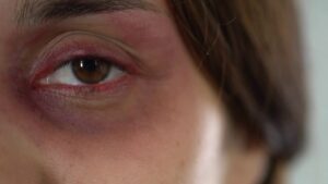 casos-de-violencia-contra-a-mulher-diminuem-quase-13%-em-juiz-de-fora,-mas-delegada-alerta-para-subnotificacao