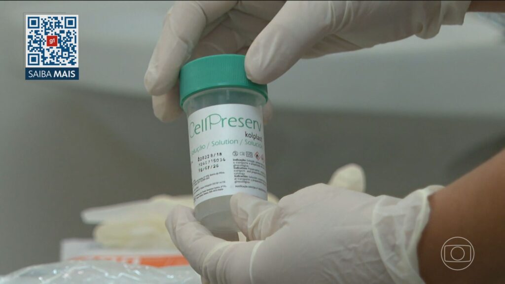 sus-comeca-a-oferecer-exame-mais-eficiente,-que-usa-tecnologia-brasileira,-para-deteccao-do-virus-hpv