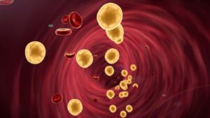 gordura-‘invisivel’-no-abdomen-e-no-figado-pode-causar-danos-silenciosos-nas-arterias,-aponta-estudo-canadense