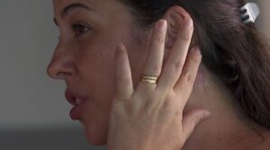 pescoco-inchado,-sangramento,-rosto-paralisado:-veja-relatos-de-mulheres-que-denunciaram-dentista-apos-complicacoes-em-procedimentos-esteticos