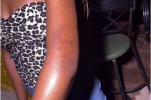 menina-de-15-anos-agredida-por-pm-diz-sentir-dores-e-que-nao-recebeu-ajuda-apos-agressao-no-carnaval