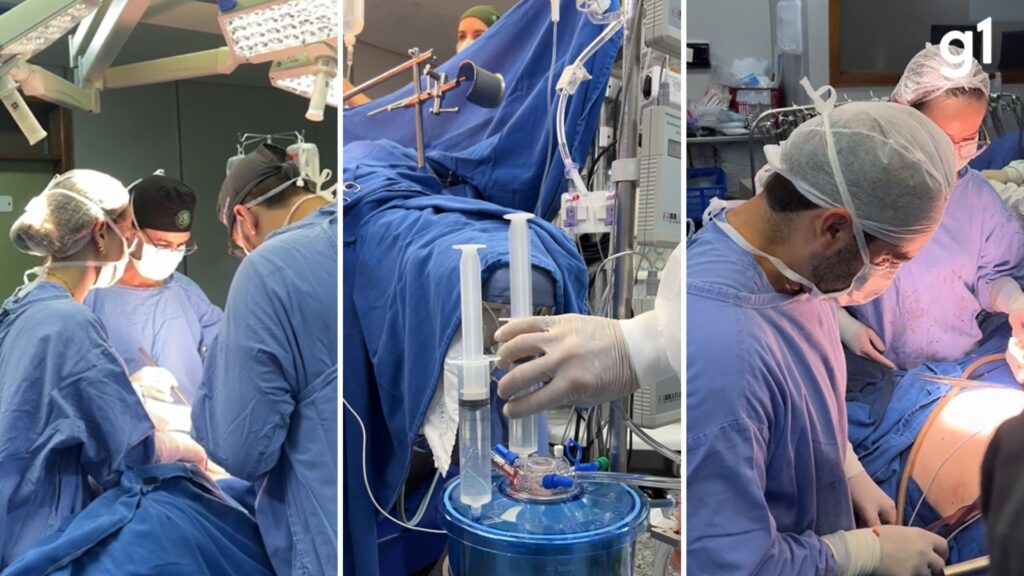 ‘unica-chance’:-paciente-com-cancer-raro-e-a-1a-a-passar-por-‘quimioterapia-aquecida’-no-interior-do-rs;-metodo-pode-ser-mais-eficaz-que-o-tradicional