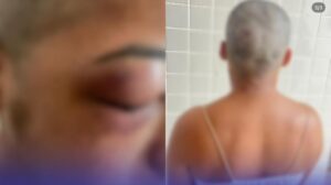 mulher-tem-cabelo-raspado-apos-agressao-e-dias-depois-sofre-atentado-a-tiros-em-almeirim,-no-para